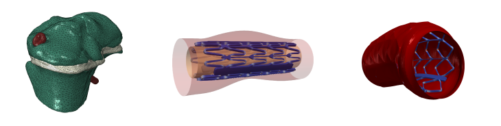 Beispiele unserer digitalen Zwillinge: Links: Fenite Elemente (FE) - Modell eines Schafsknochens mit Magnesium-Schraube (rot) durch die Wachstumsfuge (weiß). Mitte & Rechts: Stent mit Expansionsballon in einer Arterie in verschiedenen Stadien. Digitale Zwillinge 3