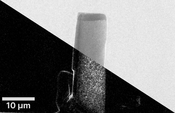 Röntgenbild1 Setcard Hereon Sami-wirtensohn