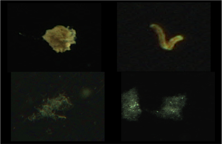 Beispielbilder verschiedener mariner Partikelformen. <i>-Bild: Klas Ove Möller/Hereon-</i> Marine Snow