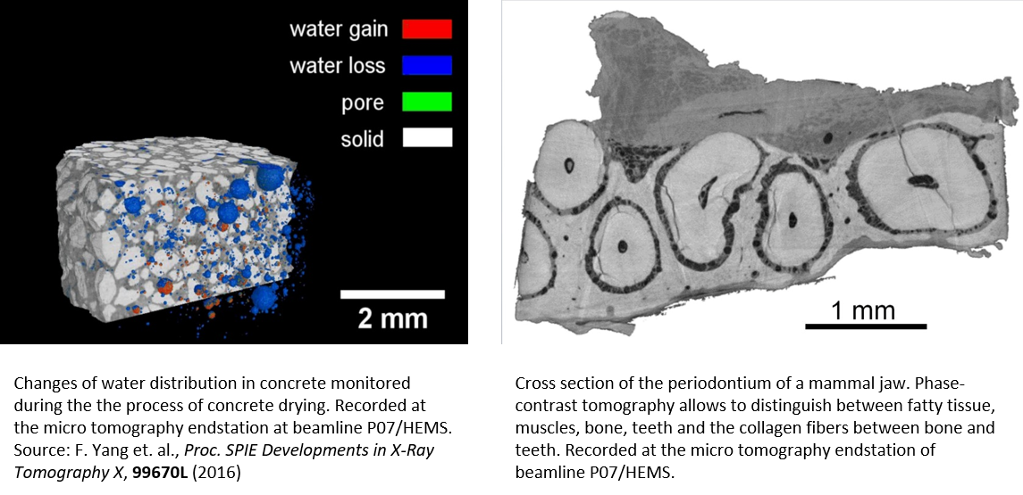 Wpi - Images 4 And 5
